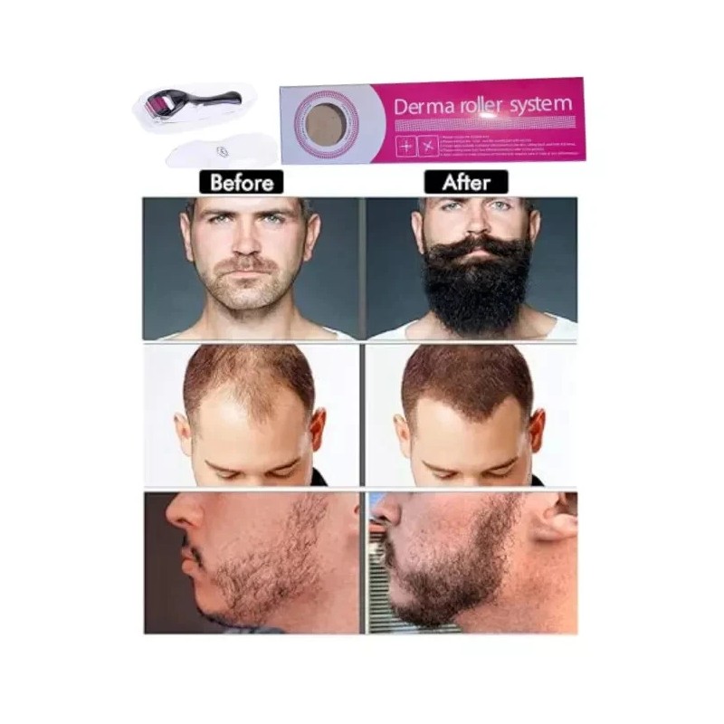 Derma Roller Beard Derma Roller For Hair Loss Beard Growth