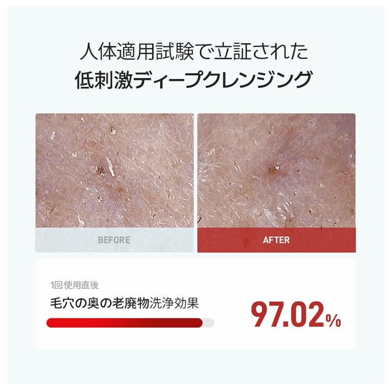 DERMAGENCY Zeroca 13 Foaming Cleanser, Pore Care, Oil Balancing Facial