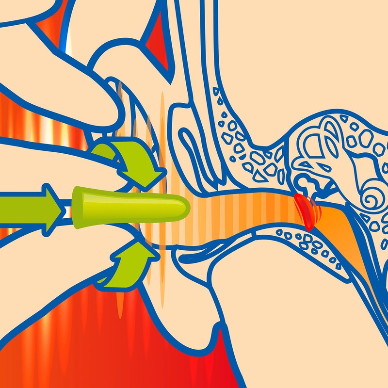 Sanohra Max Adults with Earplugs 37 SNR Noise Isolation, Pack