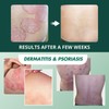 ABERA Alan Silver Nano Serum - Treat psoriasis, ringworm, restore