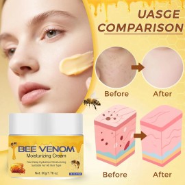 Crema Para El Tratamiento De La Piel, Crema Restauradora Upg