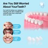 Tooth Repair Kit，Temporary Natural Shade for Filling The Gap, Moldable