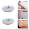 XINGYIYIJIA Egg Shape Foot Scrubber to Remove Foot Cuticles Tool