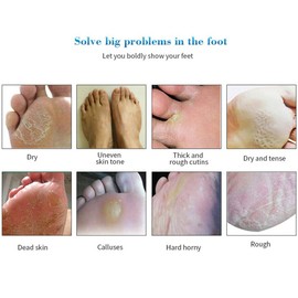 Magik Foot Peeling Mask Baby Soft Cracked Heels Remove Dead Skin Calluses (Peach, 4 Pairs)