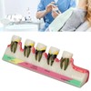 Dental Teeth Model Ceramic Clear Structure Oral Care Educational Periodontal