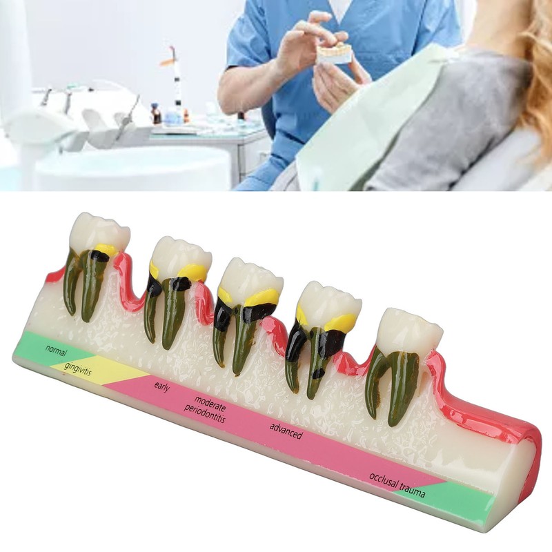 Dental Teeth Model Ceramic Clear Structure Oral Care Educational Periodontal