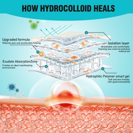 Hydrocolloid Roll for Wound Care, Large Hydrocolloid Patch Bandages with Self-Adhesive, Bed Sore Bandages, Highly Absorbent for Burn, Blister, Acne Care, Sterile and Waterproof (2in x 5ft)