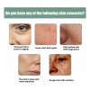 5 Piezas De Suero Facial Antiarrugas Collagen Boost Essence
