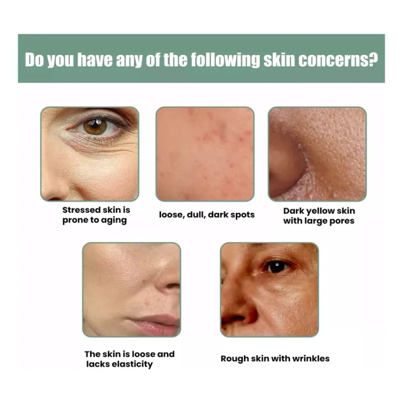 5 Piezas De Suero Facial Antiarrugas Collagen Boost Essence