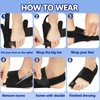 Landrain 1 Pair Hallux Valgus Correction, Hallux Valgus Splint, 2