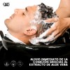 Charle Shampoo Control Caspa Sales Parabenos Extracto Aloe Vera Ayuda