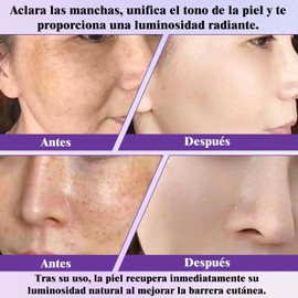 Crema Epiglow Melanex Advanced Anti-Hiperpigmentación 2pcs Retinal Cremas Tightening , Crema Reafirmante Con Retinol Antiedad Eliminador De Manchas, Hidratante Correctora De Tono