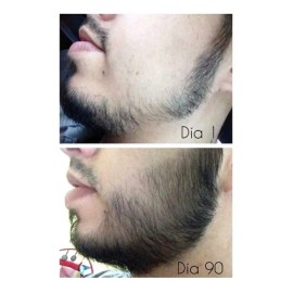 Aceite De Bergamota 120 Ml Crecimiento Cabello Y Barba