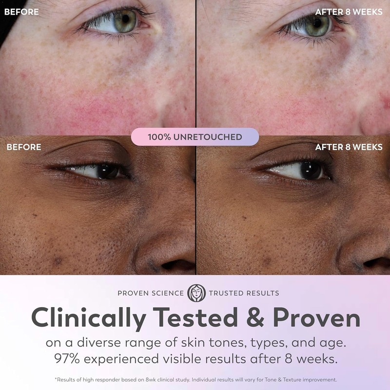 Olay Super Serum 1.0 oz con niacinamida, vitamina C, péptido