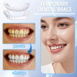 GGUFAY 2 Paare Lächeln Zähne Furniere,Prothesen Gefälschte Zähne, Komfort Sofortige Kosmetische Veneers Zähne Oben und Unten,Falsche Künstliche Temporäre Zahnspange,für Männer Frauen