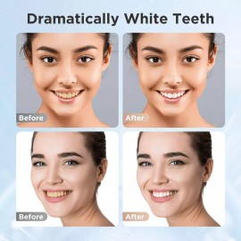 Fairywill 50 pcs Teeth Whitening Strips Non-Sensitive Teeth Whitening Non-Slip