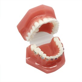Modelo de dientes de ortodoncia invisible YOUYA DENTAL modelo de dientes de enseñanza dental con soporte de metal para herramientas de enseñanza de dentista para mostrar