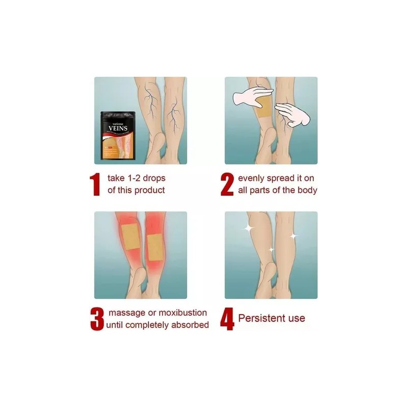 Parches Para Aliviar Las Venas Varicosas,36 Parches Por Pack Neutra