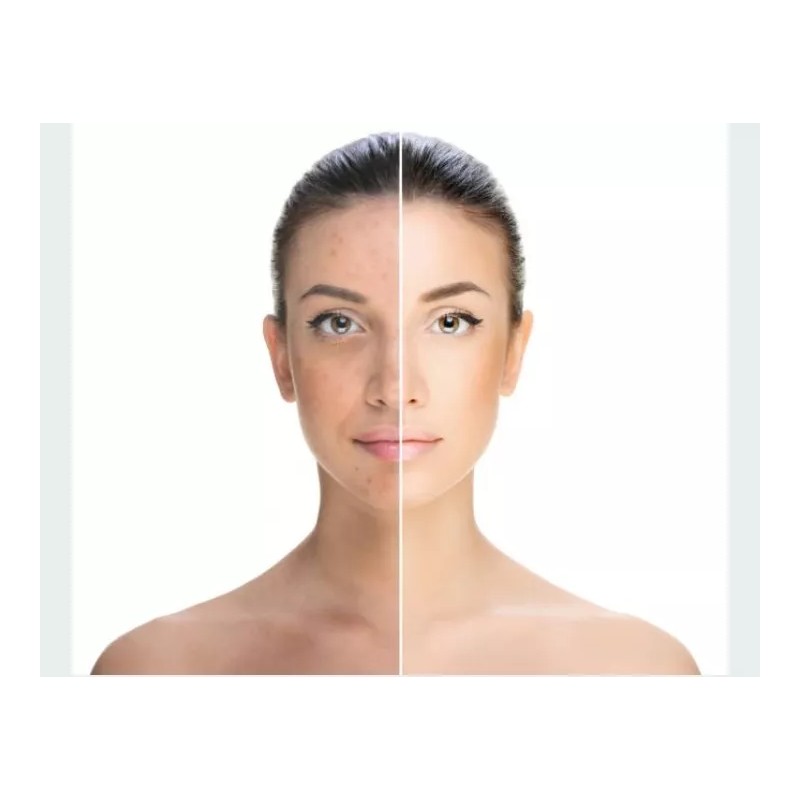 exfoliante de bamboo activado Gel Con Carbon De Bamboo Exfolia