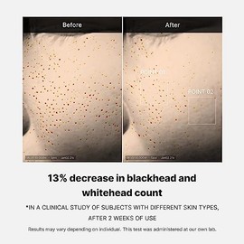 MEDICUBE Zero Pore One Day Serum, Sérum Facial Coreano con 15.2 AHA BHA PHA, Niacinamida 2 y Alantoína, para Poros Visibles, Sebo y Textura, 30 ml    