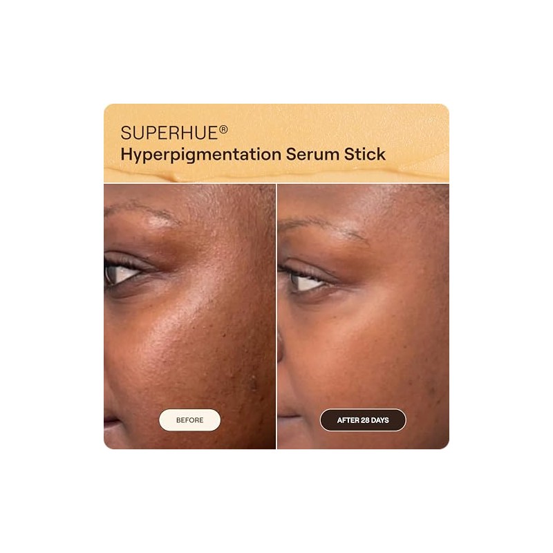 Live Tinted Superhue Hyperpigmentation Serum Stick Mini - Bálsamo-Sérum En