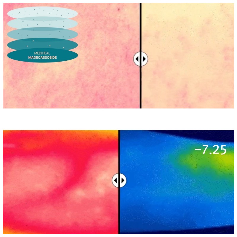 MEDIHEAL Essential Mask 24ml*10ea, Type:Rose PDRN