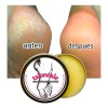 Crema Para Talones Agrietados Y Pies Secos Extra Humectante Neutra