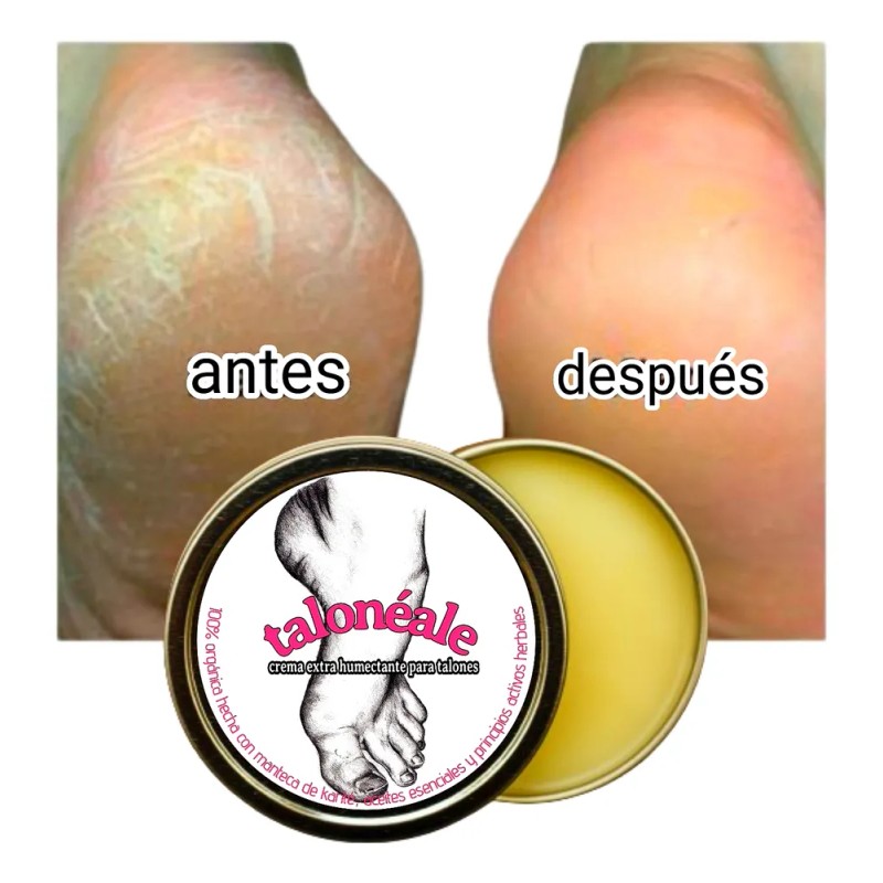 Crema Para Talones Agrietados Y Pies Secos Extra Humectante Neutra