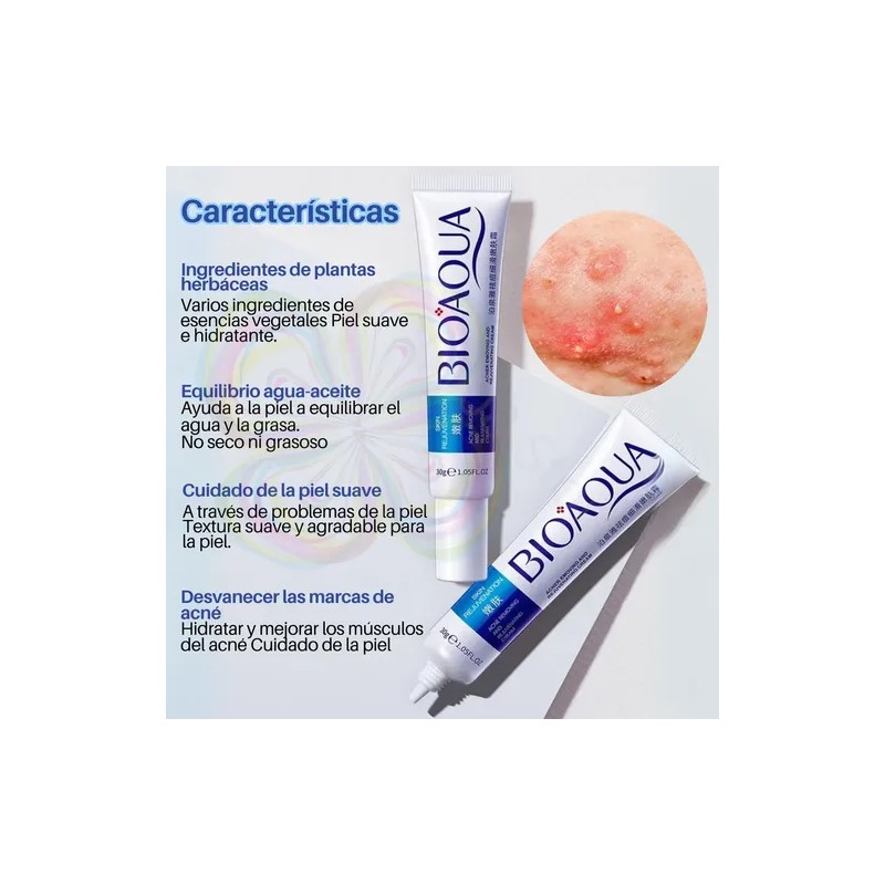 Crema Cicatrices Poros Control De Grasa Acne Cream 2pz Full