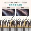 Scalp Massage Head Spa Shampoo Brush Scalp Brush Ergonomic Design