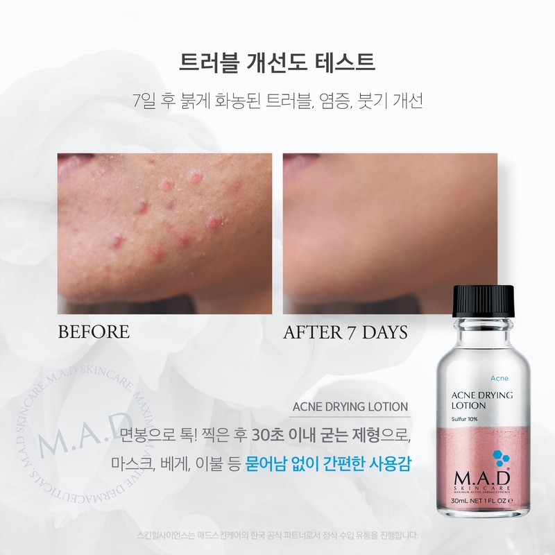 Mad Skin Care Acne Drying Lotion Pink Spot 30ml 2pcs