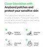Blemish Cover Patch for Targeted Spot Care Routines, Hydrocolloid-Style Skincare