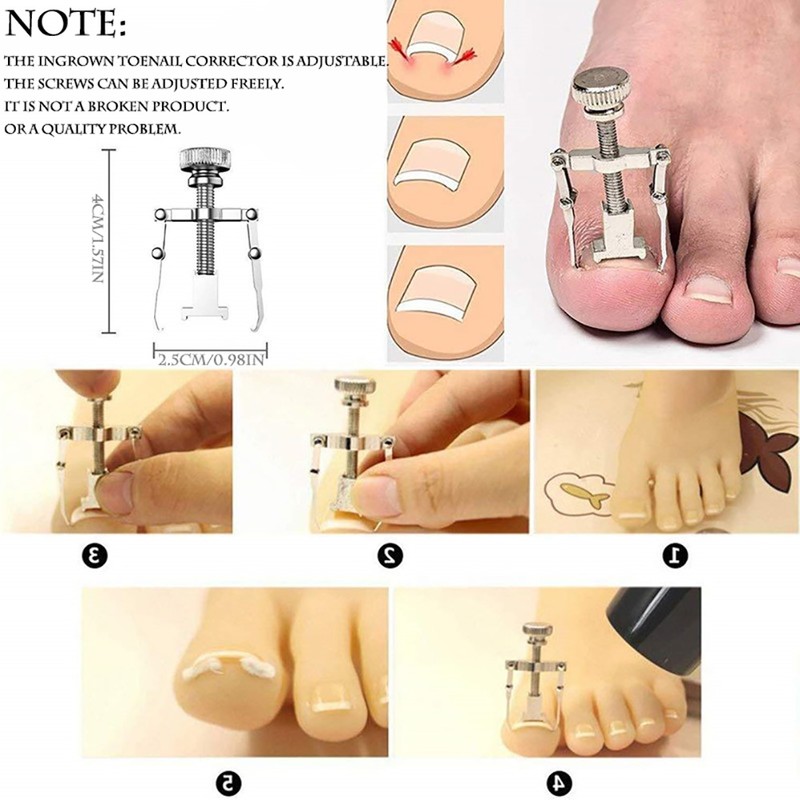 12PCS Ingrown Toenail Tool Stainless Steel Ingrown Toenail Treatment Pedicure