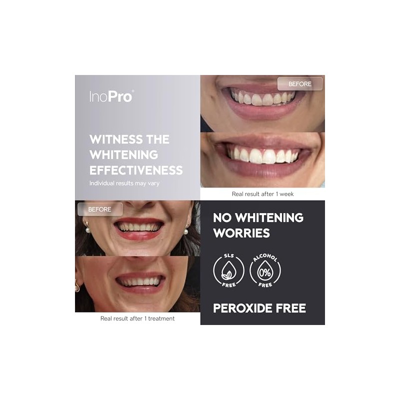 InoPro Natural Teeth Whitening Strips - Gentle Whitening for Sensitive