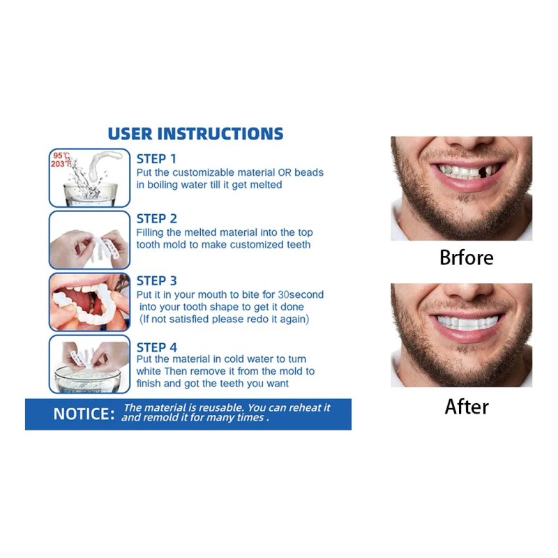 Carillas Dentales Tiras Blanqueadoras Dientes Postizos