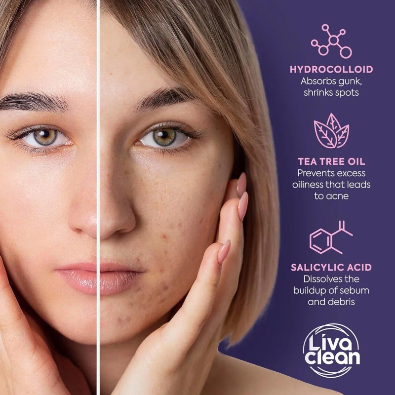 Livaclean Parches De Espinillas De Estrella Para Cara Con Hi