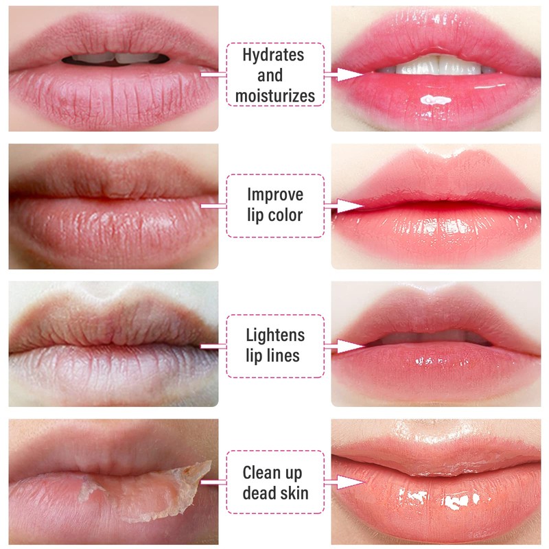 Reengull 30 PCS Lip Mask Collagen Lip Masks Sheet for