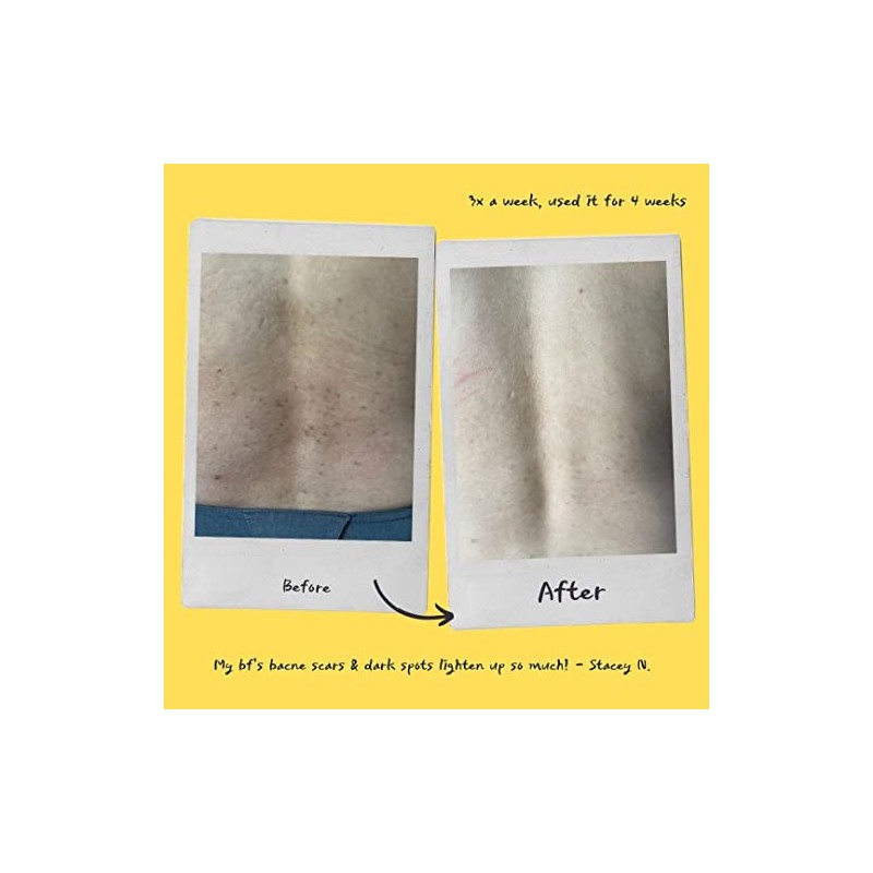 Mascarilla Exfoliante (Naranja)