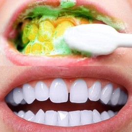 SowSmile Green Tea Dental Care Oral Hygiene Whitening Tooth Remove Smoke Stains Coffee Tea Freshen Dad Breath Powder