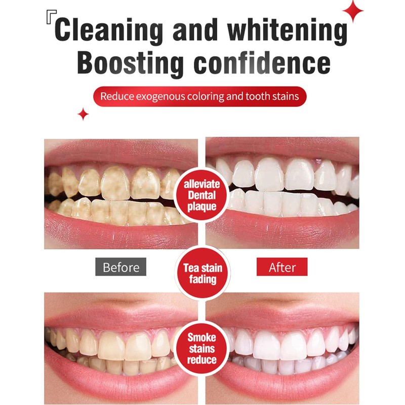 SP-6 Whitening Toothpaste, Deep Cleaning Oral Care Toothpaste, Probiotics Bright