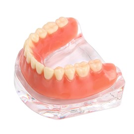 Dental Model Overdenture Transparent Dental Implants Model Detachable Model Lower Jaw Dental Teaching Model Suitable for Education and Study Silver