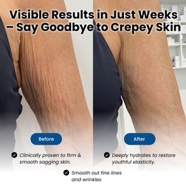 Eliré Advanced Crepe Fix- Firming & Smoothing Cream for Crepey, Aging Skin- Hydrates, Lifts & Restores Skin on Arms, Legs & Body- Fast Absorbing, Non-Greasy Formula - 120ml