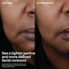 StriVectin Tighten & Lift Peptight Face Lift Serum with Tightening
