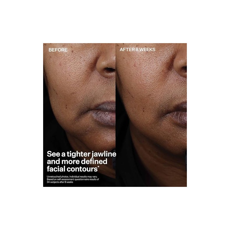 StriVectin Tighten & Lift Peptight Face Lift Serum with Tightening