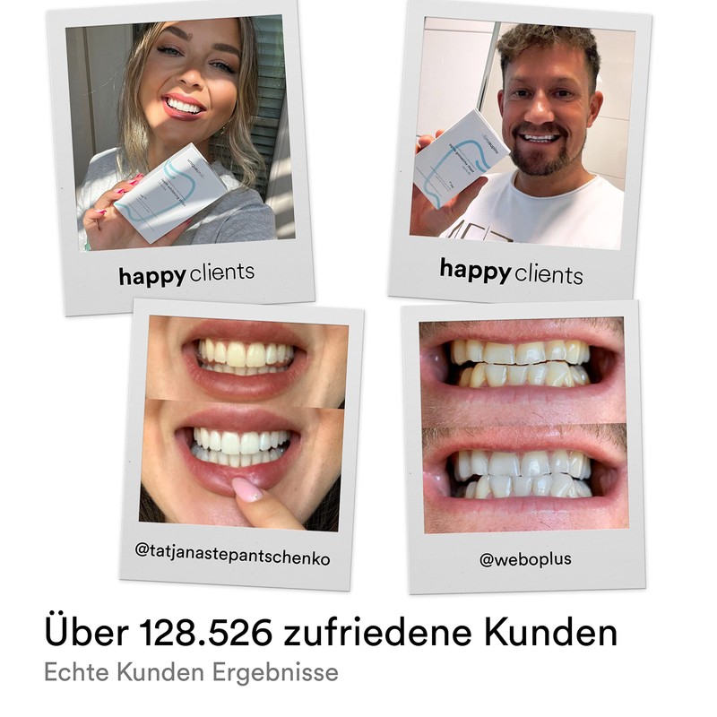 Uniquesmile Teeth Whitening Strips – Free from Peroxide – Innovative