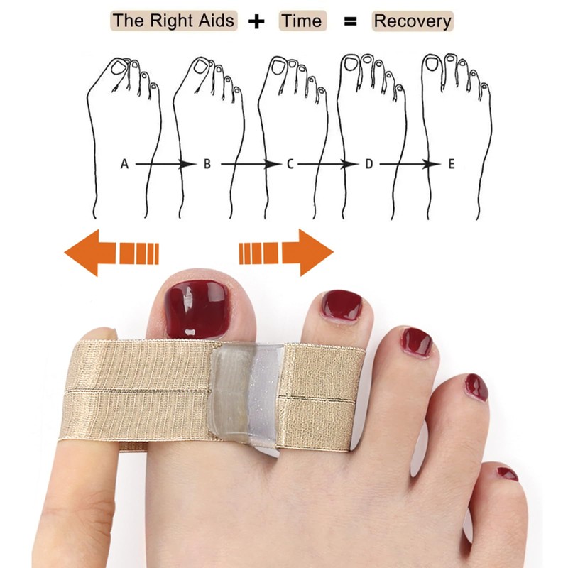 szemauy Gel Toe Spacers, Bunion Corrector with 2 Loops, Portable