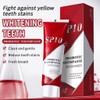 SP 10 Probiotic Whitening Toothpaste - Enhance Oral Health with
