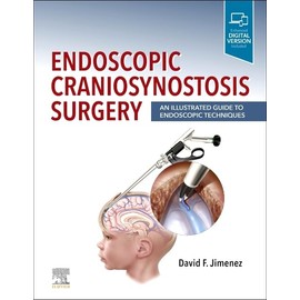 Endoscopic Craniosynostosis Surgery: An Illustrated Guide to Endoscopic Techniques