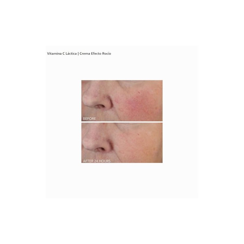 Vitamin C Plus Lactic Firm and Bright Eye Treatment by