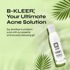 A-Cute Derm B-Kleer Cleansing Gel Acne Cleanser that Purify and